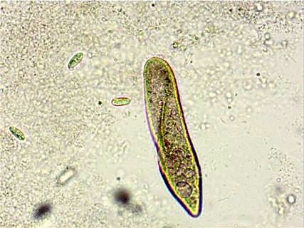 Pantoffeltierchen (Paramecium caudatum)