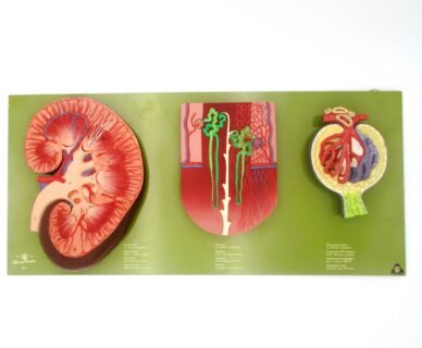Rechte Niere (3-fach vergrößert), Nephron (120-fach vergrößert), Nierenkörperchen (700-fach vergrößert)© Original SOMSO®Modell